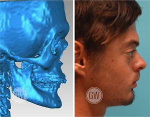 How to Sculpt a Realistic Human Head: Refining the Jaw
