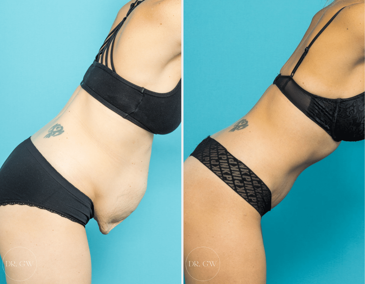 Why Support Bras Are Safer for Full-Figured Women -Fit Au Max