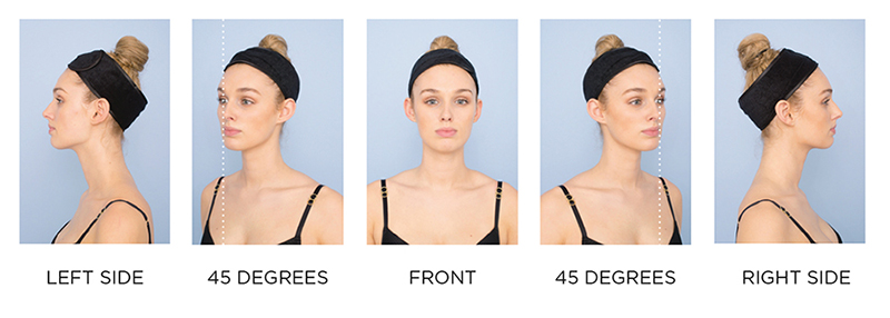 Face Lift Photo Guide Face Lift Photo Guide