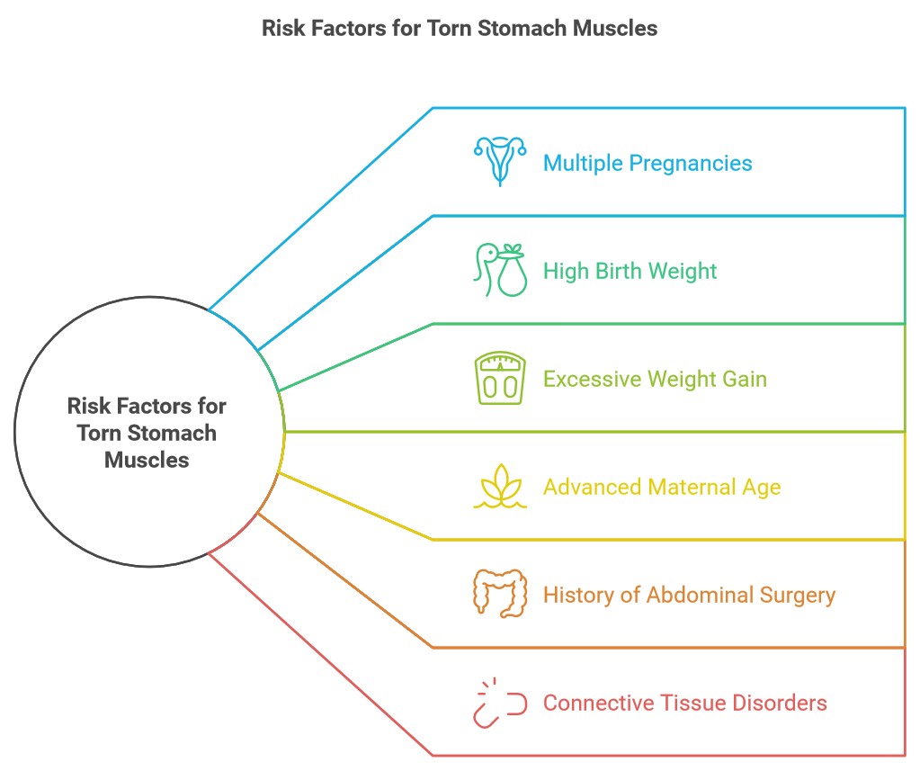 Risk factors for torn stomach muscles