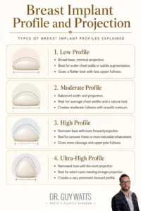 Breast Implant Profile and Projection - Infographics by Dr Guy Watts
