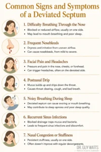 Common Signs and Symptoms of a Deviated Septum - Infographics by Dr Guy Watts