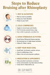 Steps to Reduce Bruising after Rhinoplasty - Infographics by Dr Guy Watts
